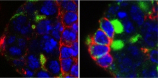 Microscòpia de les cèl·lules mare germinals (verd brillant) de l&#039;ovari de Drosophila de les mosques que no tenen EXD2. Les mosques al panell dret van ser tractades amb antioxidants per rescatar les cèl·lules mare